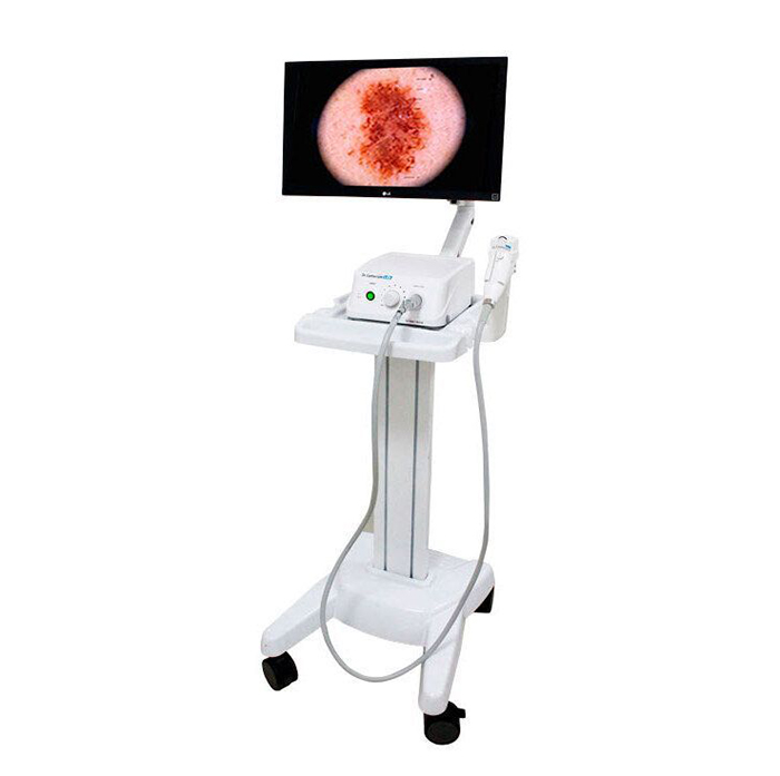 dermatoskop drcomscope 105